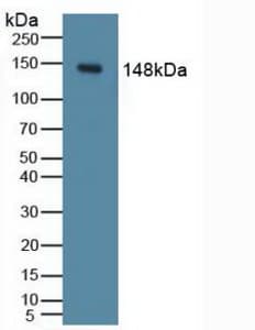 PIK3CD / PI3K Delta Antibody (aa774-1044, Biotin)