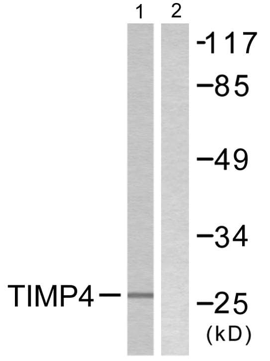 TIMP4 Antibody