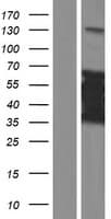 CT47A8 Protein (Over-Expression Lysate Myc-DDK (Flag))