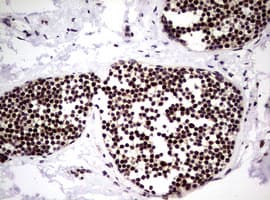 Monoclonal Mouse anti-Human NBN / Nibrin Antibody (clone OTI8E7, IHC, WB)