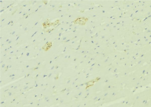 Alpha-1-Antichymotrypsin Antibody