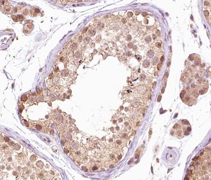 BRAF / B-Raf Antibody (phospho-Thr599)