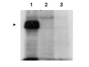 IHC-plus™ CENPU / MLF1IP Antibody