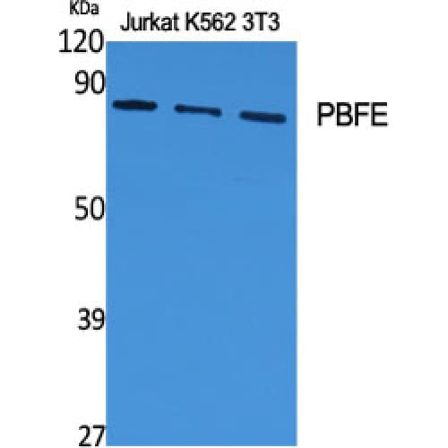 EHHADH / Enoyl-Coa Hydratase Antibody (450-530 aa, Internal)