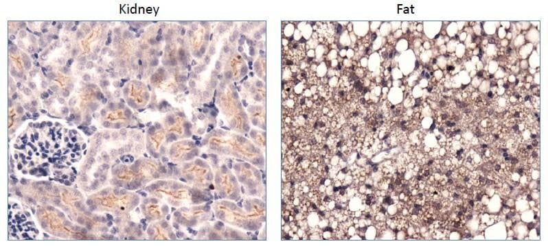 PC / Pyruvate Carboxylase Antibody (aa930-1050, DY488)