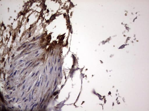 DOCK8 Antibody (aa832-1160, clone OTI4H10)