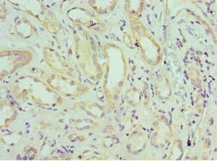 Polyclonal Rabbit anti-Human SH3GLB1 / Bif / Endophilin B1 Antibody (aa1-365, IHC, WB)