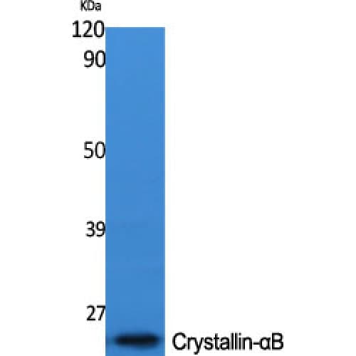 CRYAB / Alpha B Crystallin Antibody (10-90 aa)