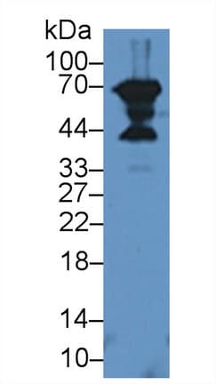 DCN / Decorin Antibody (aa31-359, PE)