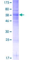 Human SSTR5 Protein (Recombinant GST)