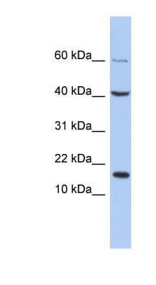 Polyclonal Rabbit anti-Human ATOH7 / MATH5 Antibody (C-Terminus, WB)