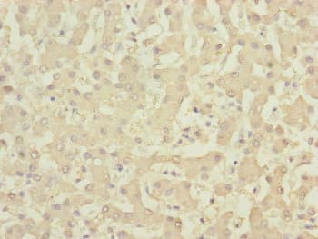DYNC2LI1 / D2LIC Antibody