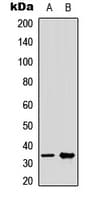 MED27 / CRSP8 Antibody (Internal)