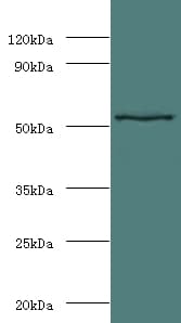 MMP3 Antibody