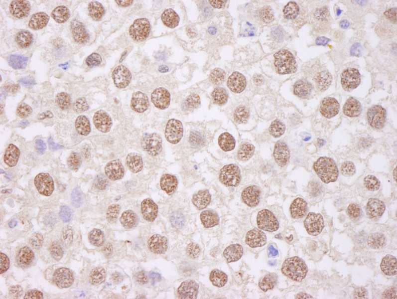 Polyclonal Rabbit anti-Human TAF15 Antibody (aa200-250, IHC, WB)