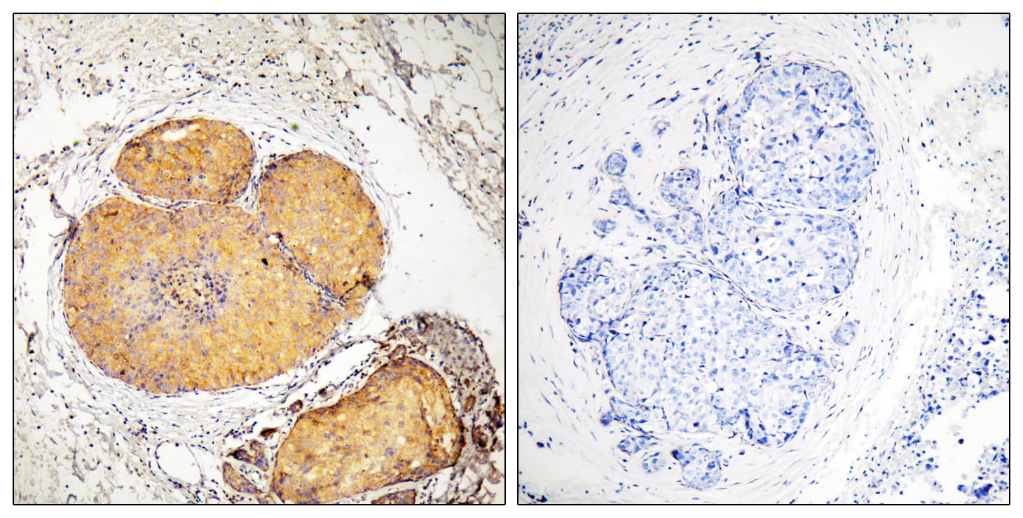 FADD Antibody (phospho-Ser191)