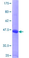 Human RGS5 Protein (Recombinant GST)
