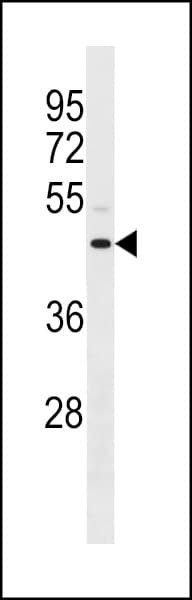 Polyclonal Rabbit anti-Human ANXA8L1 Antibody (aa77-103, WB)