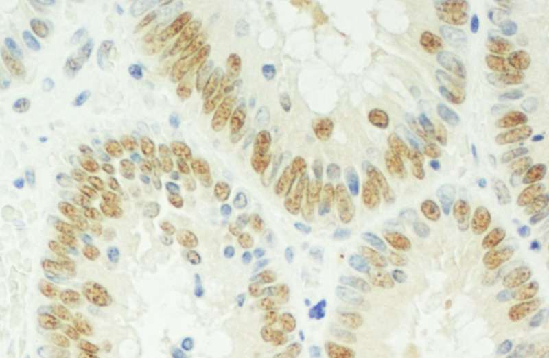 RBM17 Antibody (aa351-401)