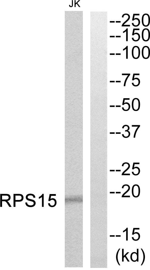 RPS15 / Ribosomal Protein S15 Antibody