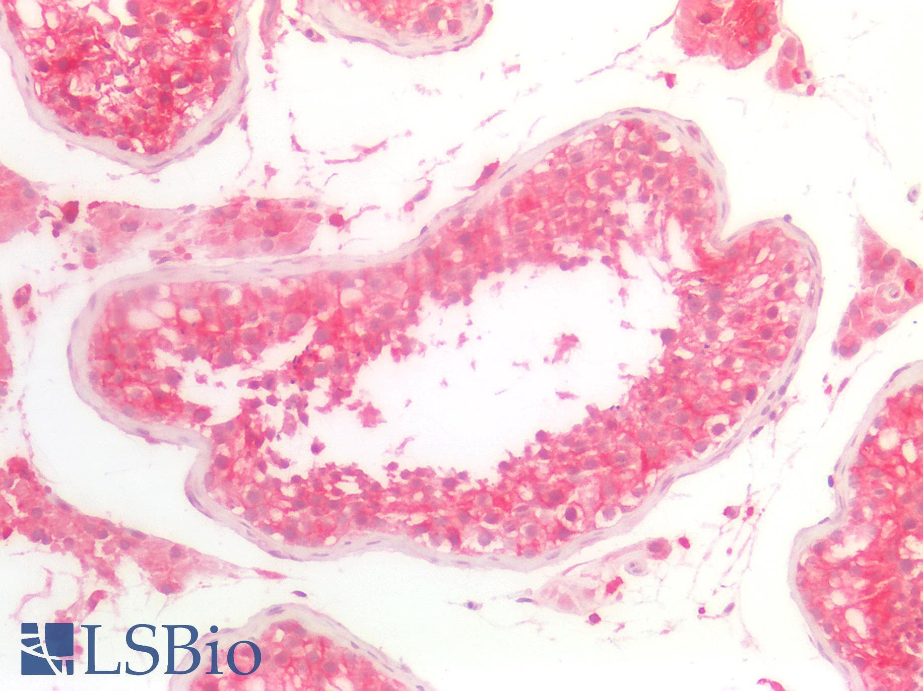 PathPlus™ NDRG1 Antibody