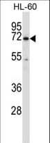 BTK Antibody (aa27-55)