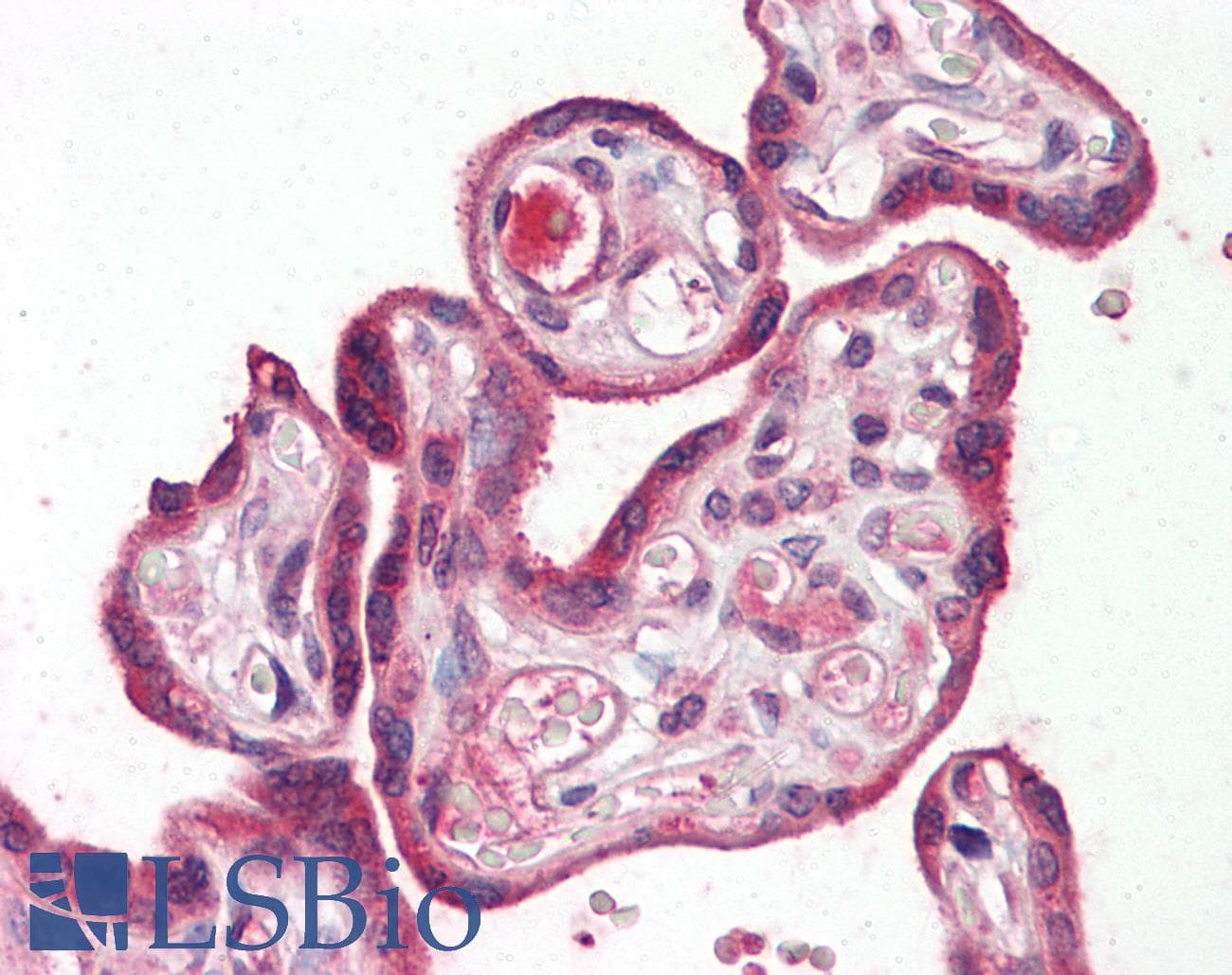 IHC-plus™ Polyclonal Rabbit anti-Human RILPL2 Antibody (IHC, IF, WB)
