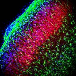TRPM2 Antibody (C-Terminus, Biotin)