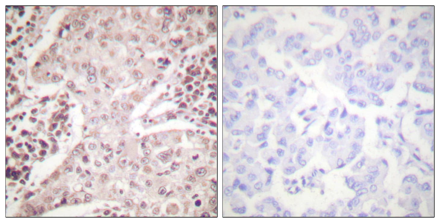 Polyclonal Rabbit anti-Human CHEK2 / CHK2 Antibody (aa361-410, IHC, WB)