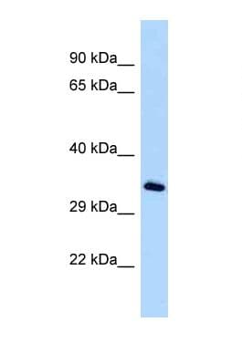 Polyclonal Rabbit anti-Human MICA Antibody (aa41-90, WB)