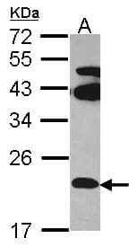 Polyclonal Rabbit anti-Human FAM18B Antibody (aa58-149, WB)