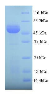 Human SUOX / Sulfite Oxidase Protein (Recombinant His)