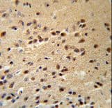 ALS2 / Alsin Antibody (aa1248-1277)