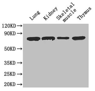Ces1c / Carboxylesterase 1C Antibody