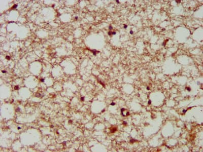 Polyclonal Rabbit anti-Human TASP / LANCL2 Antibody (IHC, IF, WB)