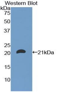 CD8B / CD8 Beta Antibody (aa22-170)
