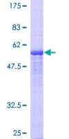 Human Dexras1 / RASD1 Protein (Recombinant GST)