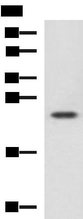 CBX5 / HP1 Alpha Antibody