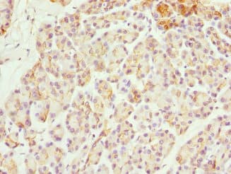 FXYD2 Antibody
