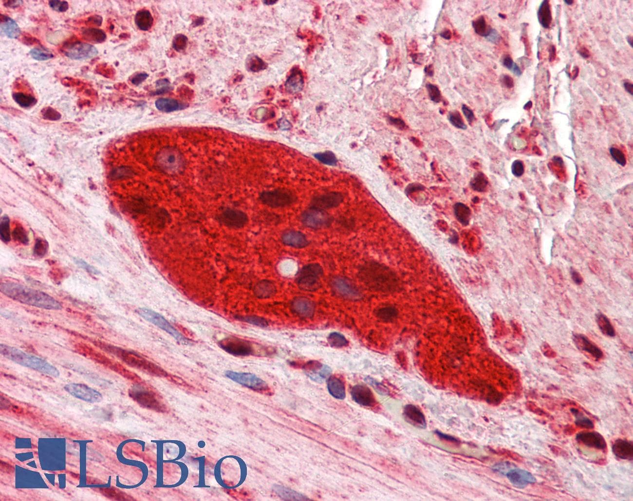 Polyclonal Rabbit anti-Human ZEB2 / SIP-1 Antibody (C-Terminus, IHC, WB)