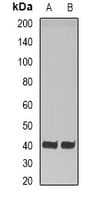 HAO1 Antibody