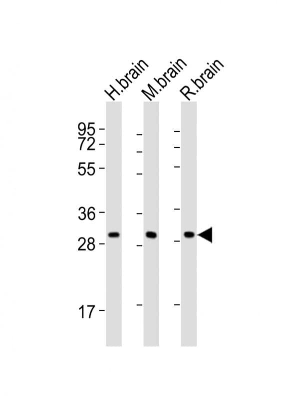 Polyclonal Rabbit anti-Human KCNMB2 Antibody (aa174-189, WB)