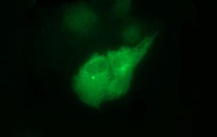 TUBB2B / Tubulin Beta 2B Antibody (clone OTI2H4, Carrier-free)