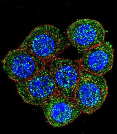 Polyclonal Rabbit anti-Human FAK / Focal Adhesion Kinase Antibody (aa821-848, IHC, IF, WB)