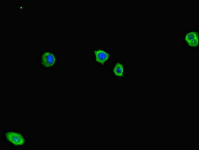 ADCY1 / Adenylate Cyclase 1 Antibody (aa416-610)