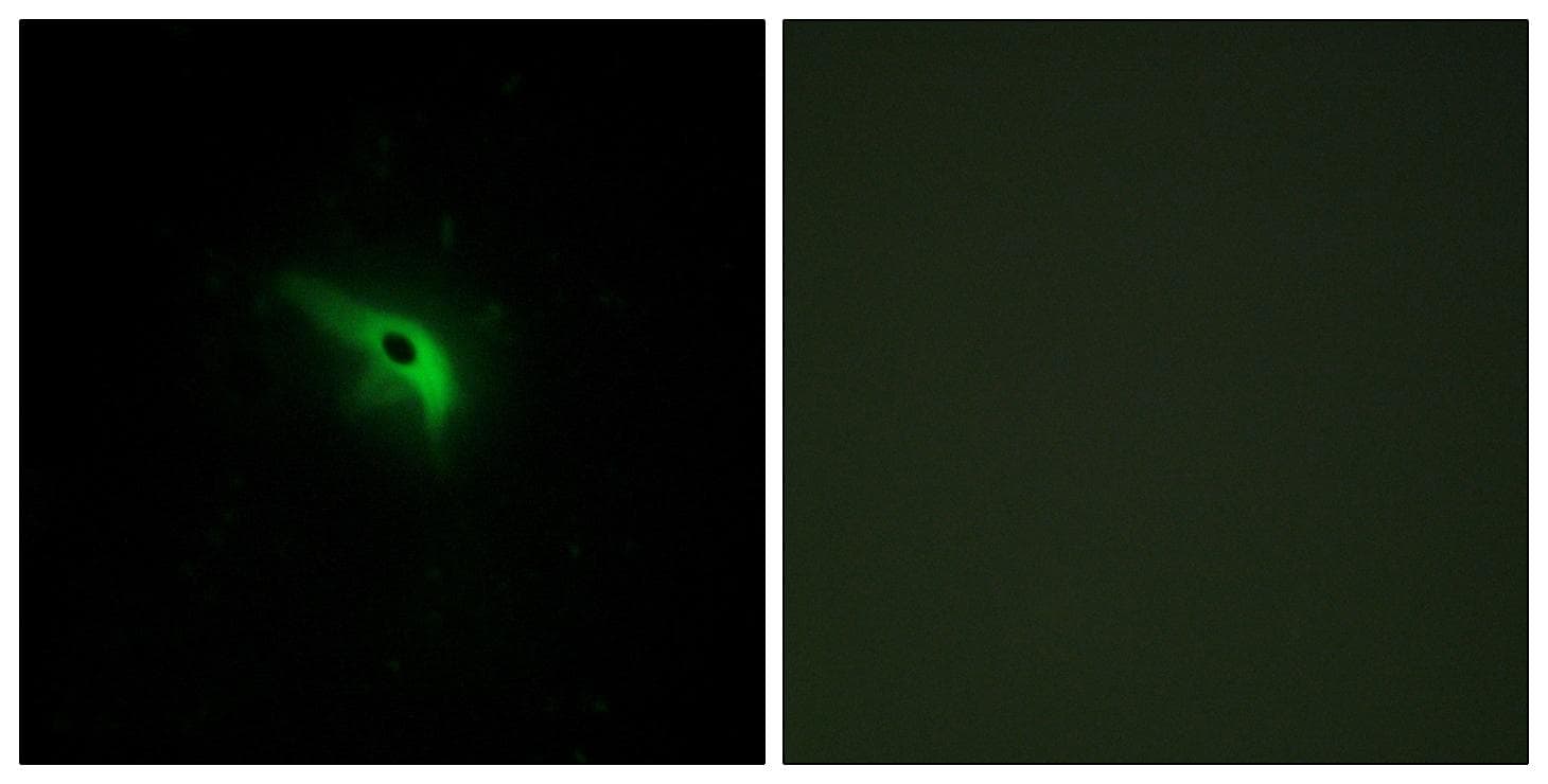 TP53AIP1 / p53 AIP1 Antibody