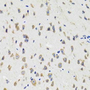 IKBKG / NEMO / IKK Gamma Antibody