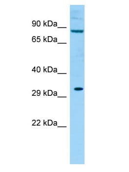 Polyclonal Rabbit anti-Rat KIRREL2 / FILTRIN Antibody (aa451-500, WB)