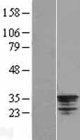 MMS21 / NSMCE2 Protein (Over-Expression Lysate Myc-DDK (Flag))