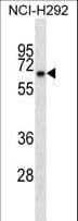 KBTBD10 / Sarcosin Antibody (aa547-575)